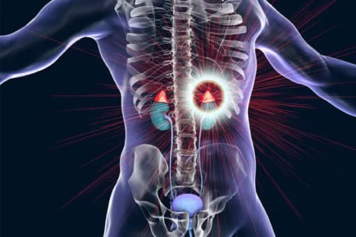 10-Minute Scan Enables Detection and Cure of Common Cause of High  Blood Pressure