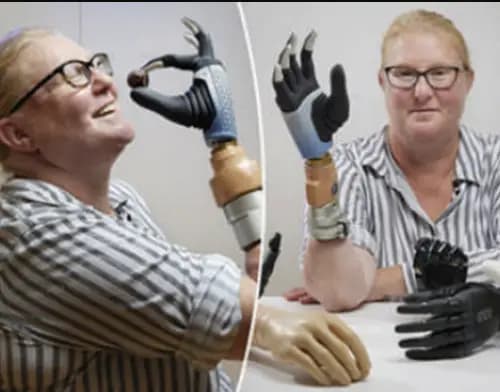 Bionic woman’ is first to have robotic limb merged with bone and controlled with her mind.